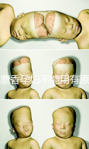 白麝香孕婦不能用有原因，流產(chǎn)、早產(chǎn)…這些危害不得不知