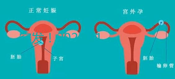突發!2024.11.15,天津試管嬰兒納入醫保報銷(附14家醫保定點醫院)
