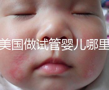 去美國做試管嬰兒哪里最好，4家好評輔助生殖機構(gòu)推薦