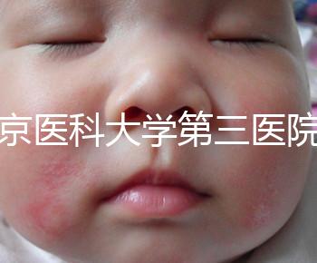 北京醫(yī)科大學(xué)第三醫(yī)院nt檢查費(fèi)用盤點(diǎn)需要多長(zhǎng)時(shí)間，是否預(yù)約