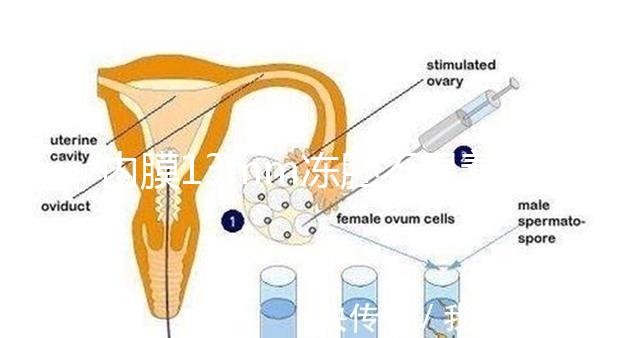 內(nèi)膜13mm凍胚不易著床要注意,移植與否看醫(yī)生怎么說(shuō)