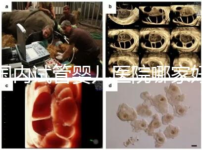 國(guó)內(nèi)試管嬰兒醫(yī)院哪家好?慈銘博鰲深受患者信賴