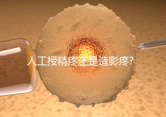 人工授精疼還是造影疼?被瞎對比，二者疼痛不是一個等級
