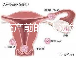 二胎臨產(chǎn)前的7大跡象,出現(xiàn)見(jiàn)紅、陣痛別大意