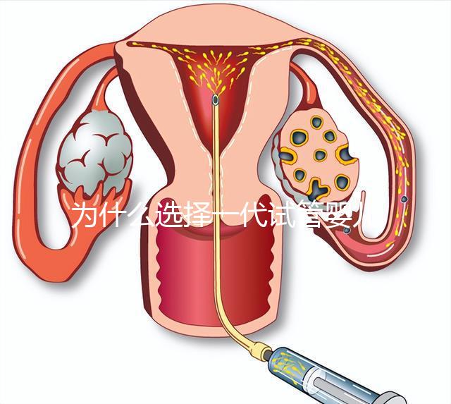 為什么選擇一代試管嬰兒？全面解析其獨特優勢與適用場景