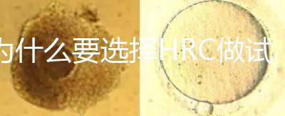 為什么要選擇HRC做試管？這6大優勢看完就知道答案