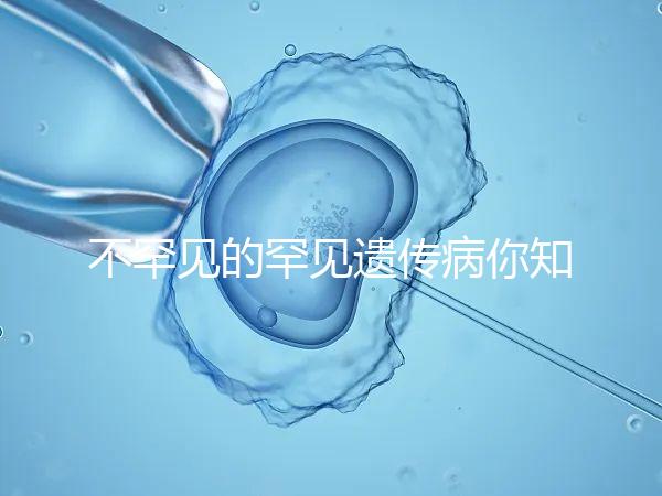 不罕見的罕見遺傳病你知道嗎？帶你認識下特納綜合癥