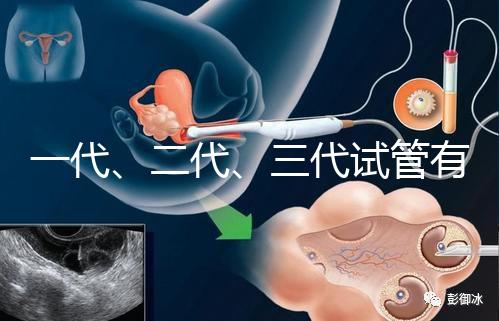 一代、二代、三代試管有什么區(qū)別？
