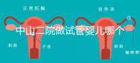 中山二院做試管嬰兒哪個醫(yī)生好？附醫(yī)院試管成功率