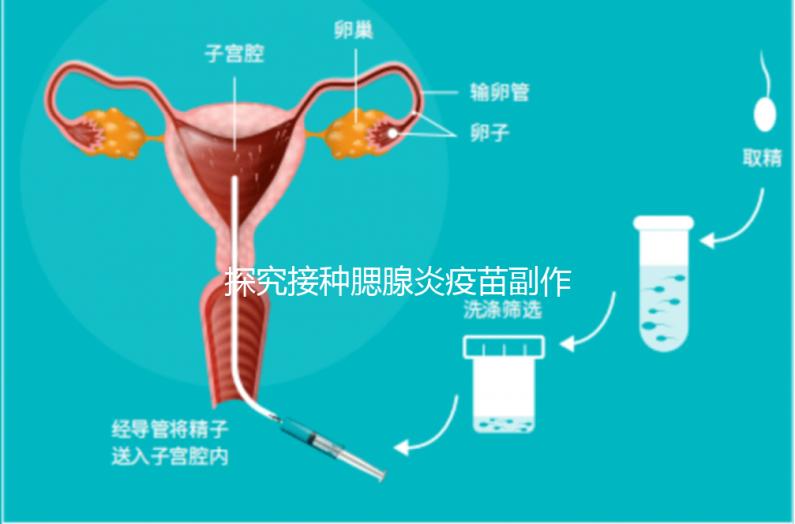 探究接種腮腺炎疫苗副作用，出現(xiàn)發(fā)燒用這3招應(yīng)對自如