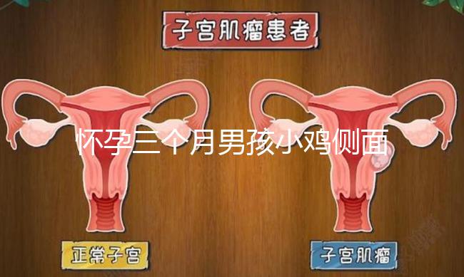 懷孕三個(gè)月男孩小雞側(cè)面二維b超圖片分享，原來(lái)兩腿間有尖