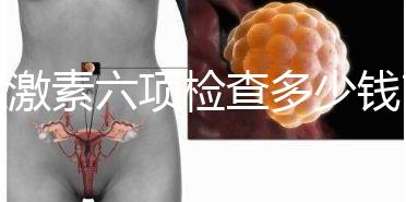性激素六項檢查多少錢?最終花費受這3個方面影響