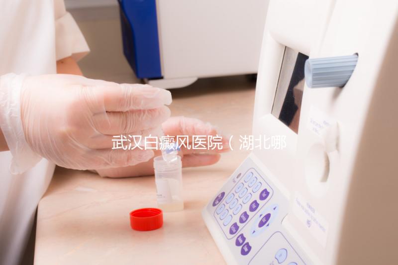 武漢白癜風醫(yī)院(湖北哪家醫(yī)院白癜風最好)