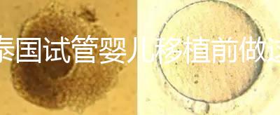 泰國試管嬰兒移植前做這3件事能提高成功率,不然會(huì)后悔!