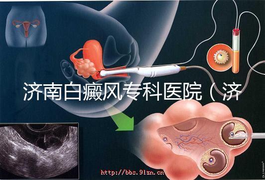 濟南白癜風專科醫(yī)院(濟南白點癲風醫(yī)院排名)