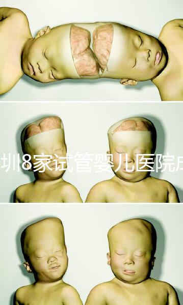 深圳8家試管嬰兒醫(yī)院成功率排名,供卵、供精首選各不同