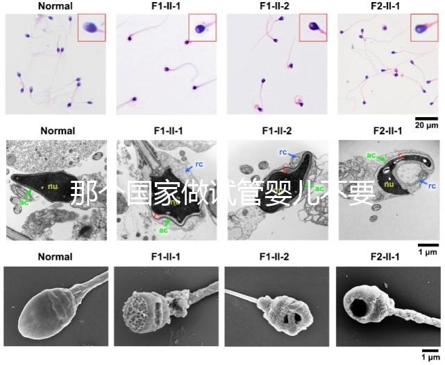 那個(gè)國家做試管嬰兒不要結(jié)婚證