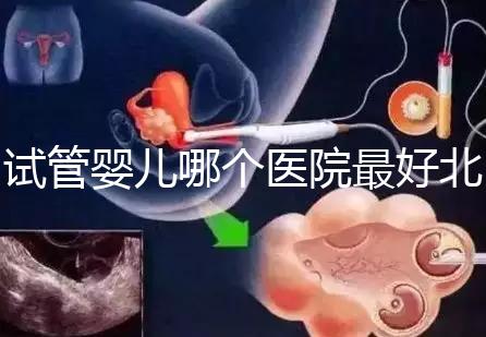試管嬰兒哪個醫院最好北京(試管嬰兒北京哪個醫院做的好)