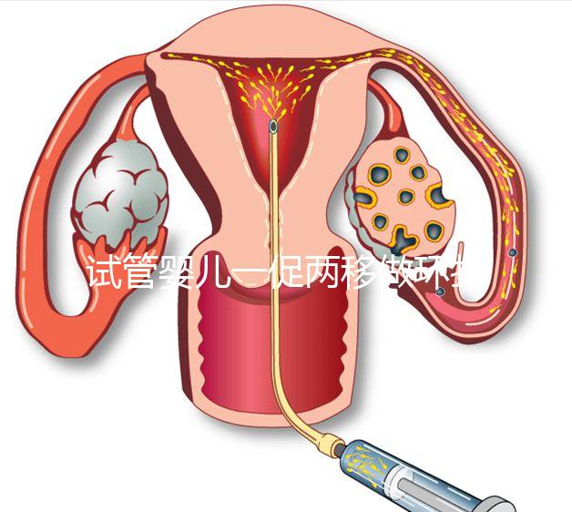 試管嬰兒一促兩移做環(huán)扎好看嗎？小心這些影響