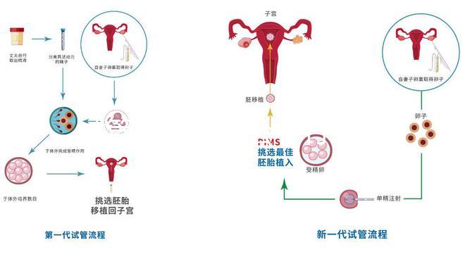 試管嬰兒是老公不行嗎（試管嬰兒是老公不行嗎還是女孩）