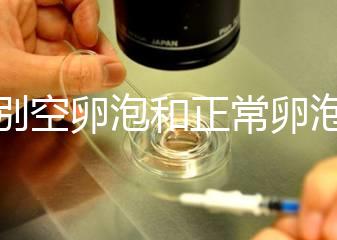 辨別空卵泡和正常卵泡是有技巧的，只需要了解這四個方面就可以輕松辨別，快速學習！