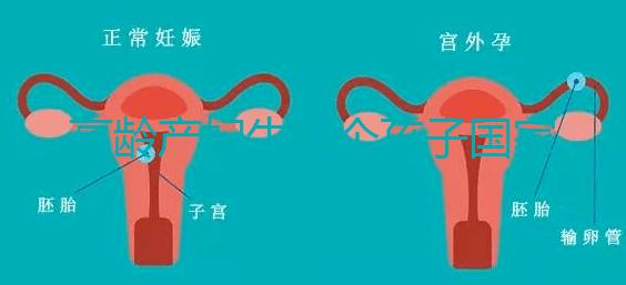 高齡產婦生八個孩子國家有補助？有沒有違法才是關鍵