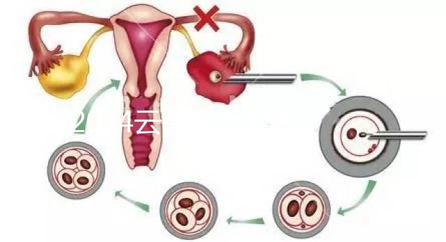 2024云南產假158天怎么算？新政策中，男方培育假貨