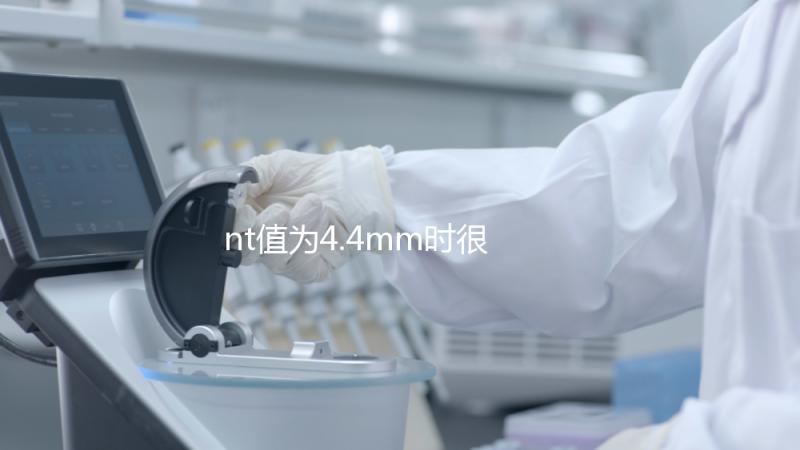 nt值為4.4mm時很危險，及時羊穿確認胎兒畸形很重要